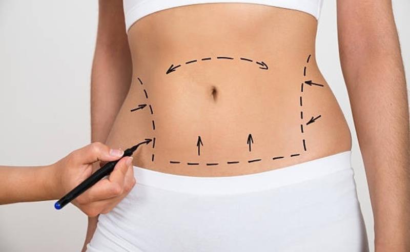 Mini lipo em consultório ganha espaço no Brasil e reflete nova busca por procedimentos rápidos e menos invasivos